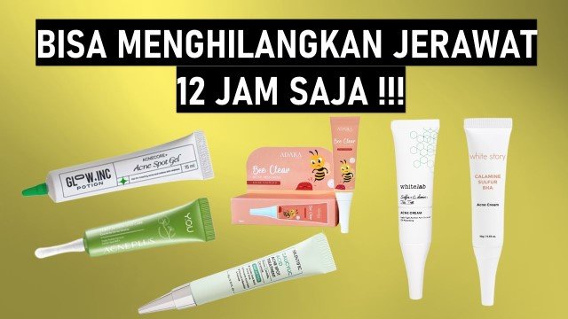 Tak Khawatir Berbekas! 5 Rekomendasi Obat Jerawat Ampuh: Bisa Kempeskan dalam Semalam