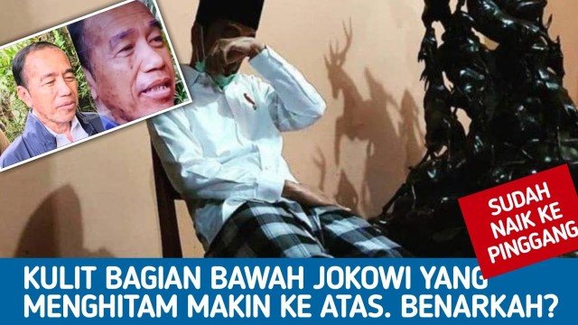 Perubahan Fisik Jokowi Sungguh di Luar Nalar Medis!