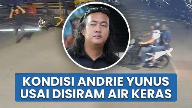 Mata Kanan Terluka Parah! Begini Kondisi Medis Korban Penyiraman Air Keras Andrie Yunus