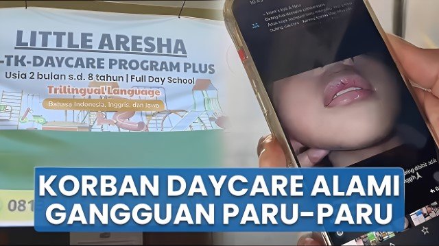 Mengerikan! Tertipu Citra Profesional, Orang Tua Ini Ungkap Horor di Balik Daycare Little Aresha