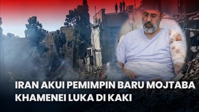 UPDATE! Mojtaba Khamenei Cacat Parah, Wajah dan Bibir Tunggu Operasi Plastik, Kaki Buntung Diganti Prostetik