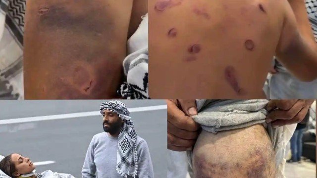 Biadab! Disetrum Hingga Dipukul Setengah Mati, Begini Kondisi Mengerikan WNI Yang Diculik Israel