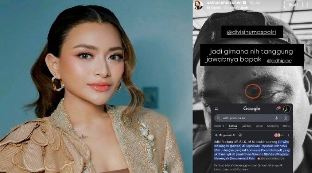 Dunia Hiburan Gempar! Oknum Polisi Diduga Tembak Bodyguard Nathalie Holscher, Ada Apa?