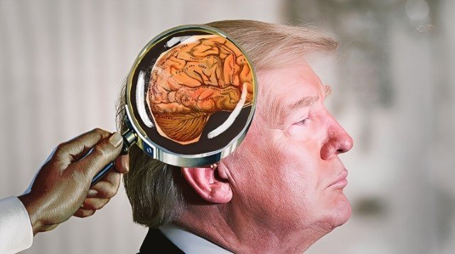 Panas! Kongres AS Pertanyakan 'Kesehatan Mental' Donald Trump