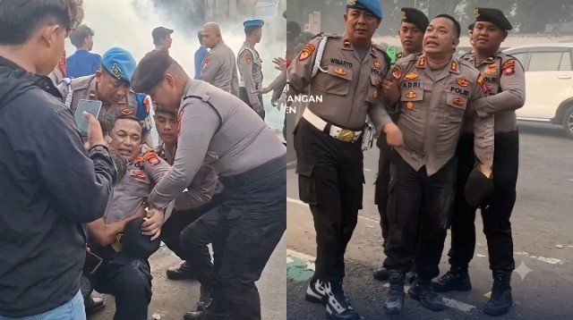 Teriak ‘Kaki Patah’ Saat Demo Ricuh, Ternyata Ini Diagnosis Mengejutkan dari Tim Medis untuk AKBP Adri Desas