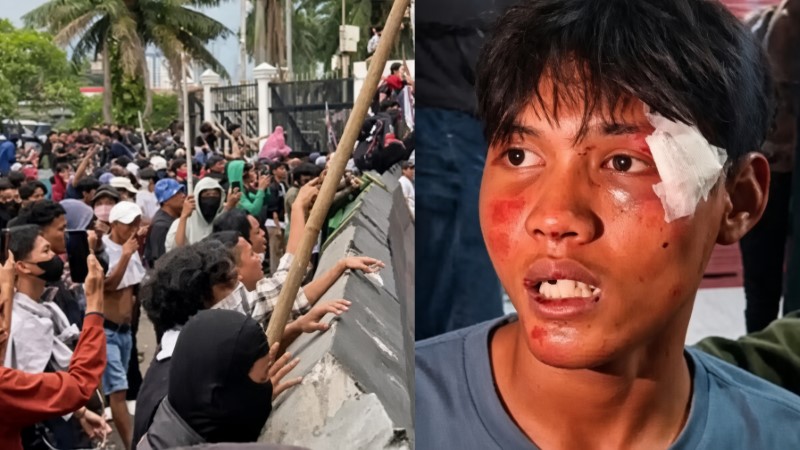 Aksi Kekerasan Oknum Aparat! Faturohman Jadi Korban Salah Tangkap, Diseret ke DPR, Dipukuli Brutal hingga Gigi Rontok