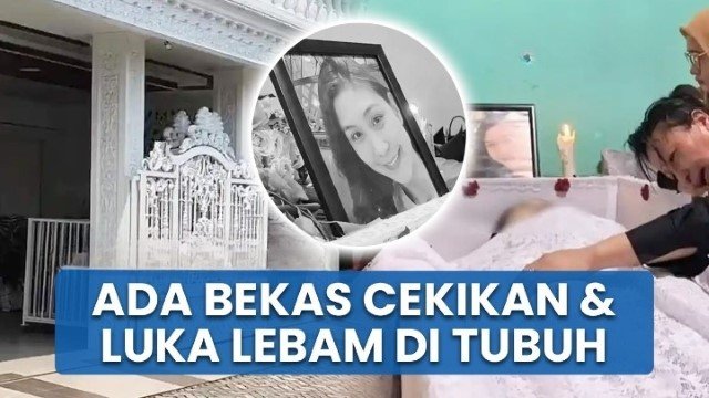 Fakta Baru Kematian Eks Istri Polisi di Medan: Keluarga Soroti Bekas Cekikan dan Luka Lebam!